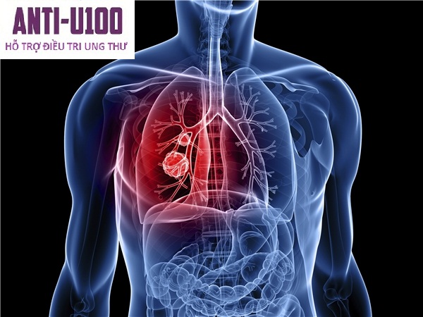 Sức khỏe, đời sống: Phòng ngừa bệnh ung thư phổi như thế nào? Ung-thc6b0-phe1bb95i